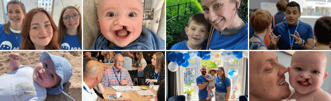 Cleft Lip And Palate Association