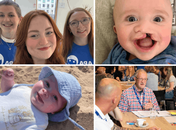 Cleft Lip And Palate Association