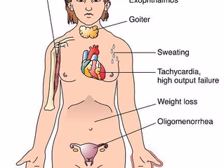 The Robert James Graves Foundation SCIO