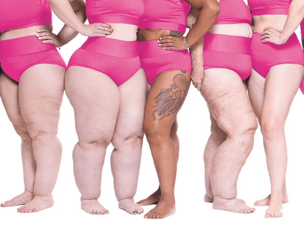 Lipoedema UK