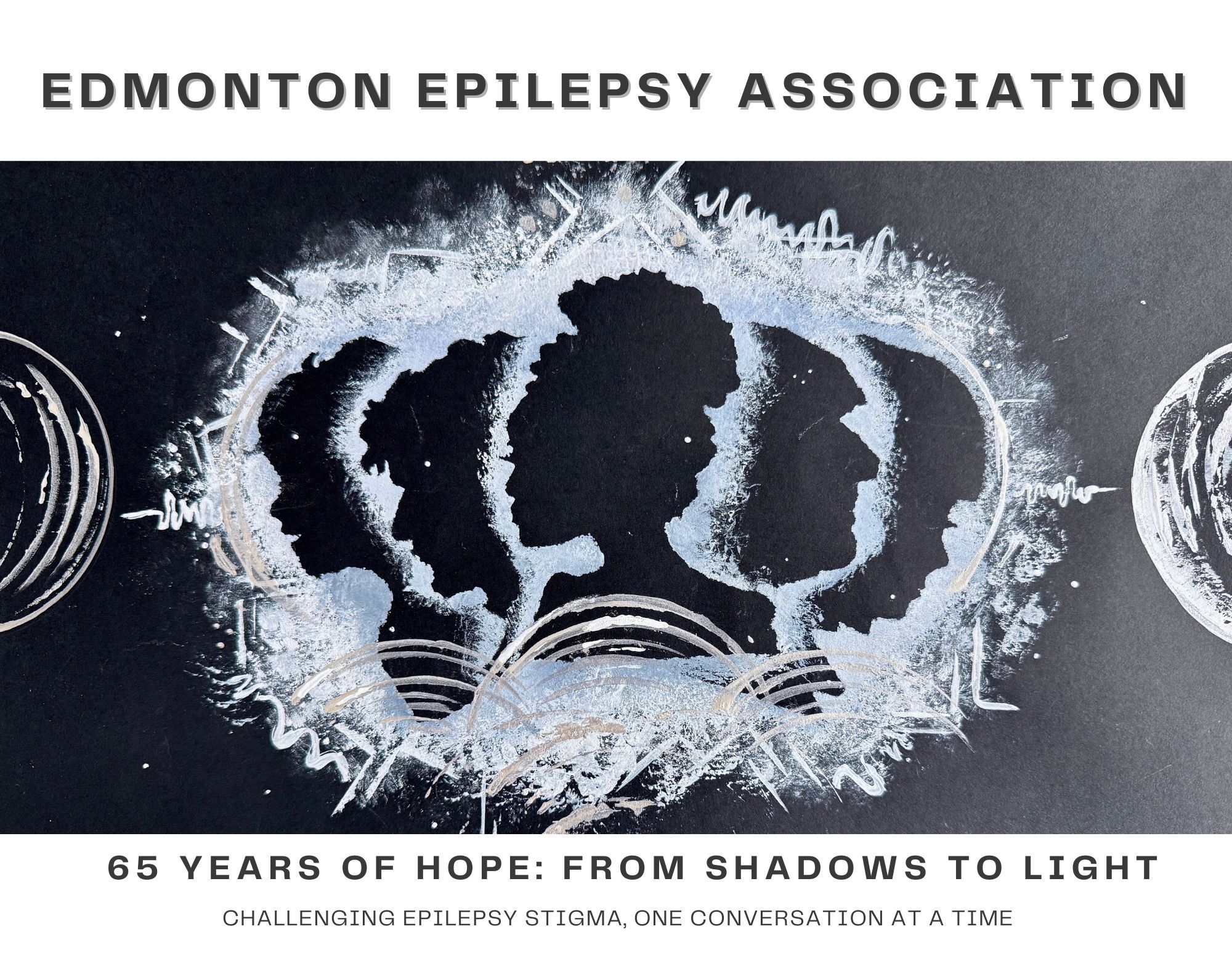 Edmonton Epilepsy Association