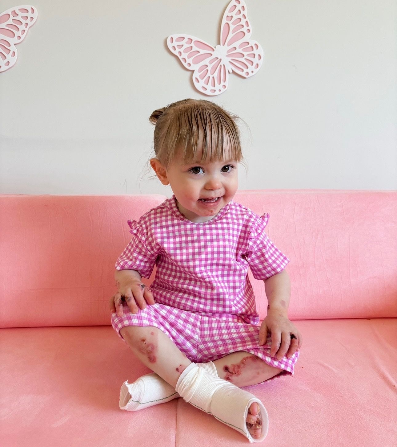 Cure EB Charity Foundation Limited