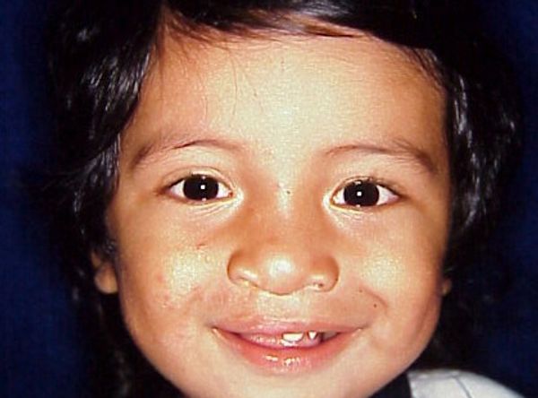 Pacific Clinical Research Foundation DBA Smiles International Foundation