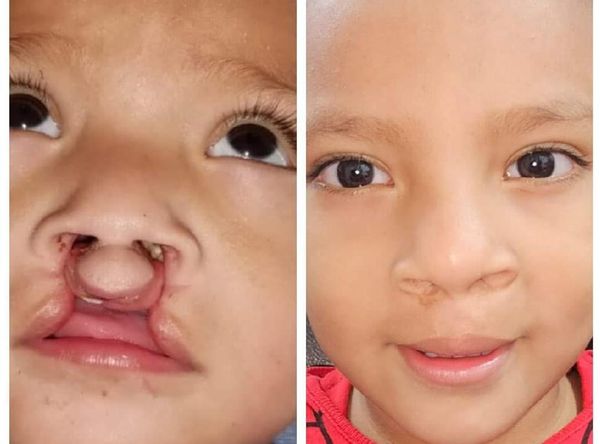 Pacific Clinical Research Foundation DBA Smiles International Foundation