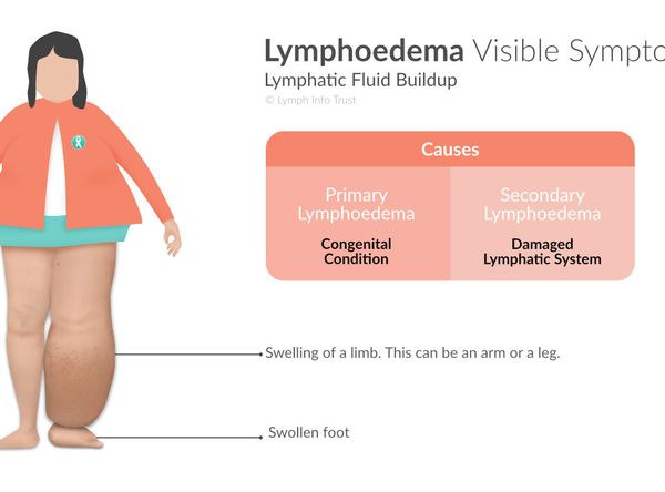 Lymph Info Trust