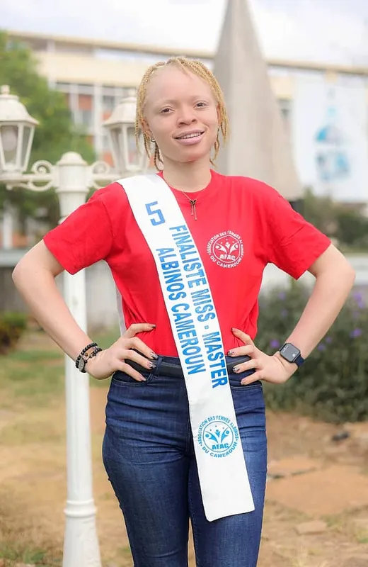 YOGO MBEUNKEU Line Patricia