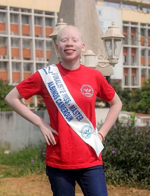 MBIMBE MOUTO Annelise  Shiny