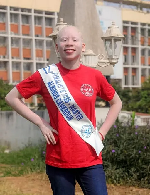 MBIMBE MOUTO Annelise Shiny