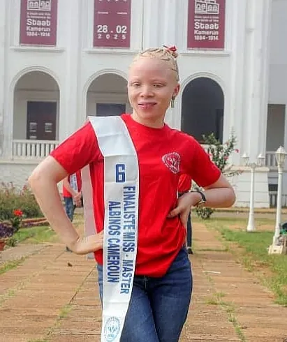 MIBO MISSI Patience Bre