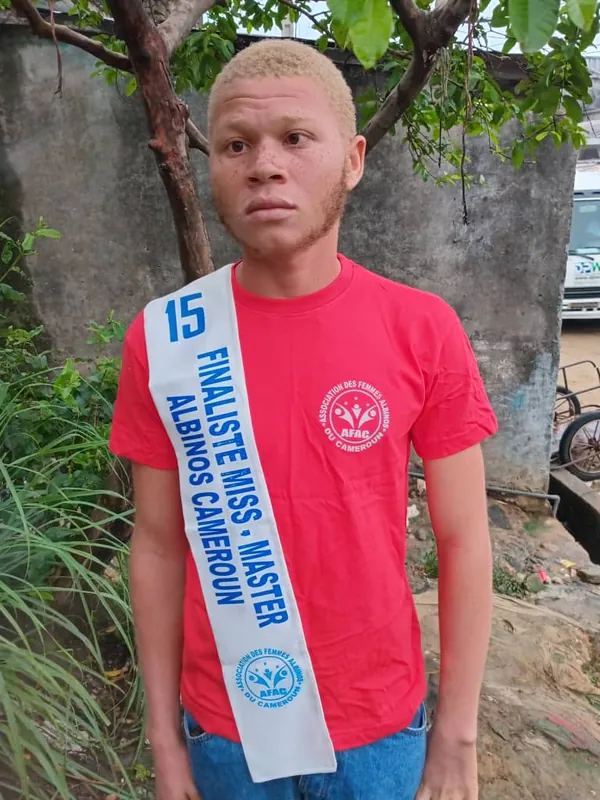 Rivaldo Walson Assondjou