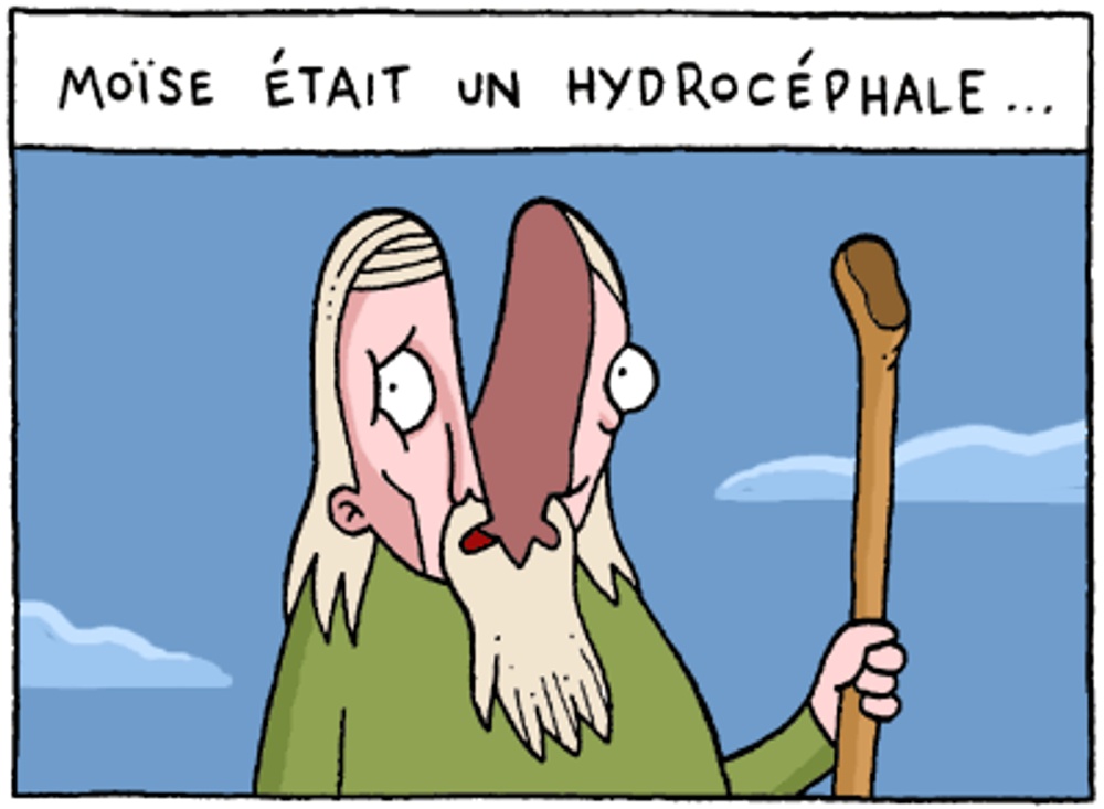 Hydrocéphale